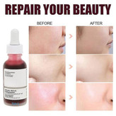 سرم پیلینگ اوردینری AHA 30% + BHA 2% – لایه بردار قوی