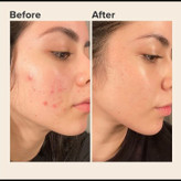 کرم ترمیم کننده اون مدل سیکالفیت پلاس حجم 40 میلی لیتر - اصل